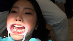 素人まことさんのリアル歯科治療映像（６回目）