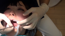 素人あおいさんのリアル歯科治療映像（３回目）