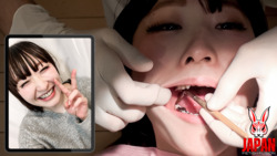 POV : Amateur Aoi's real dental treatment video (4th time)