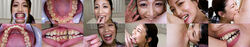 [包含 5 个特典视频] 有贺美奈穗的牙齿和咬合系列 1-3 DL 一次全部完成